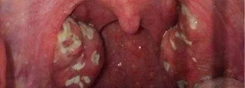 ChCE4FwEWn6IJX2UAABJuPqCM_gABH_eQP5kbgAAEnQ009.jpg